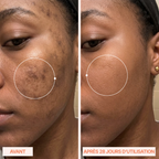 SERUM ANTI TACHES